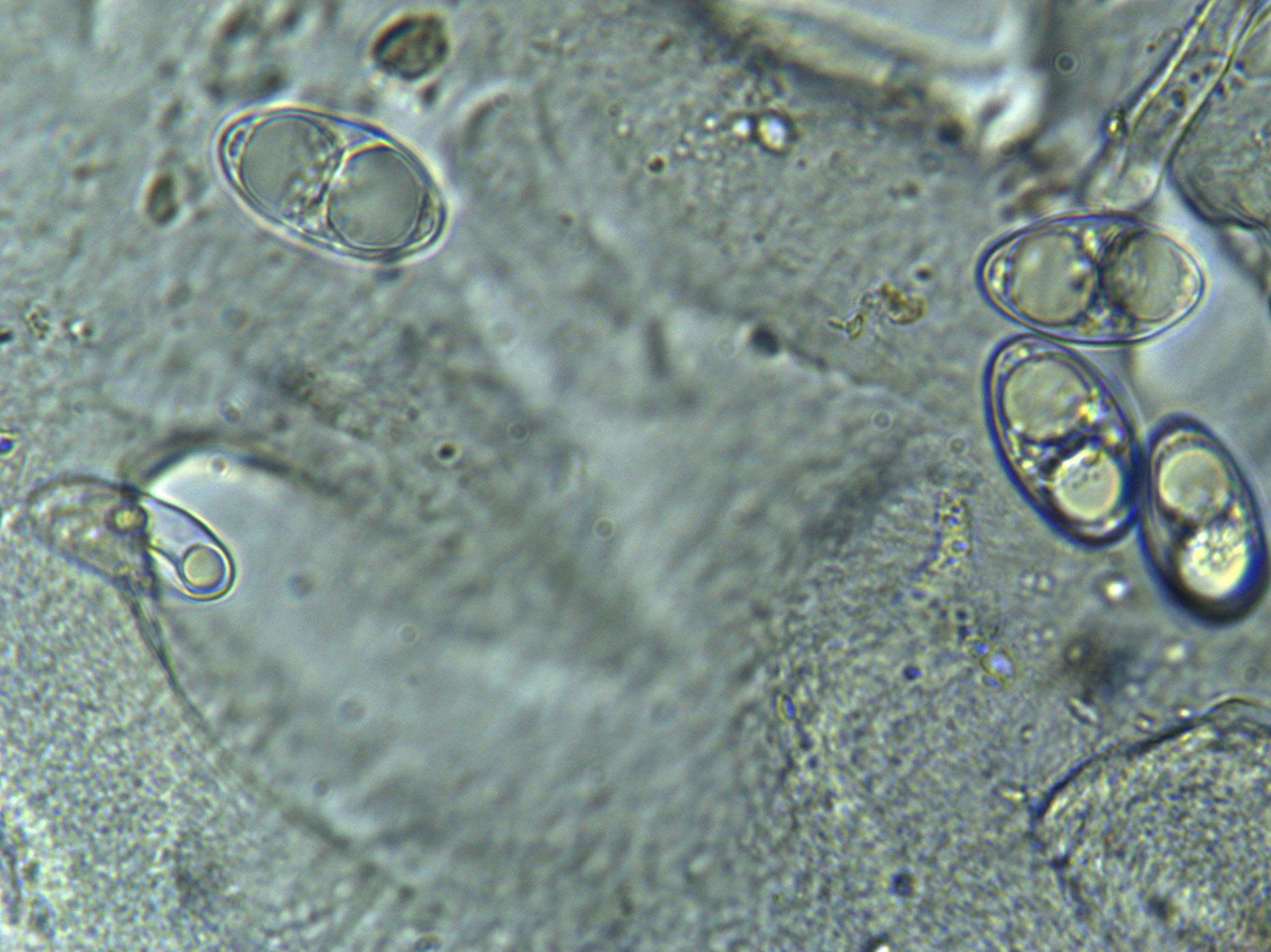 Spore in acqua