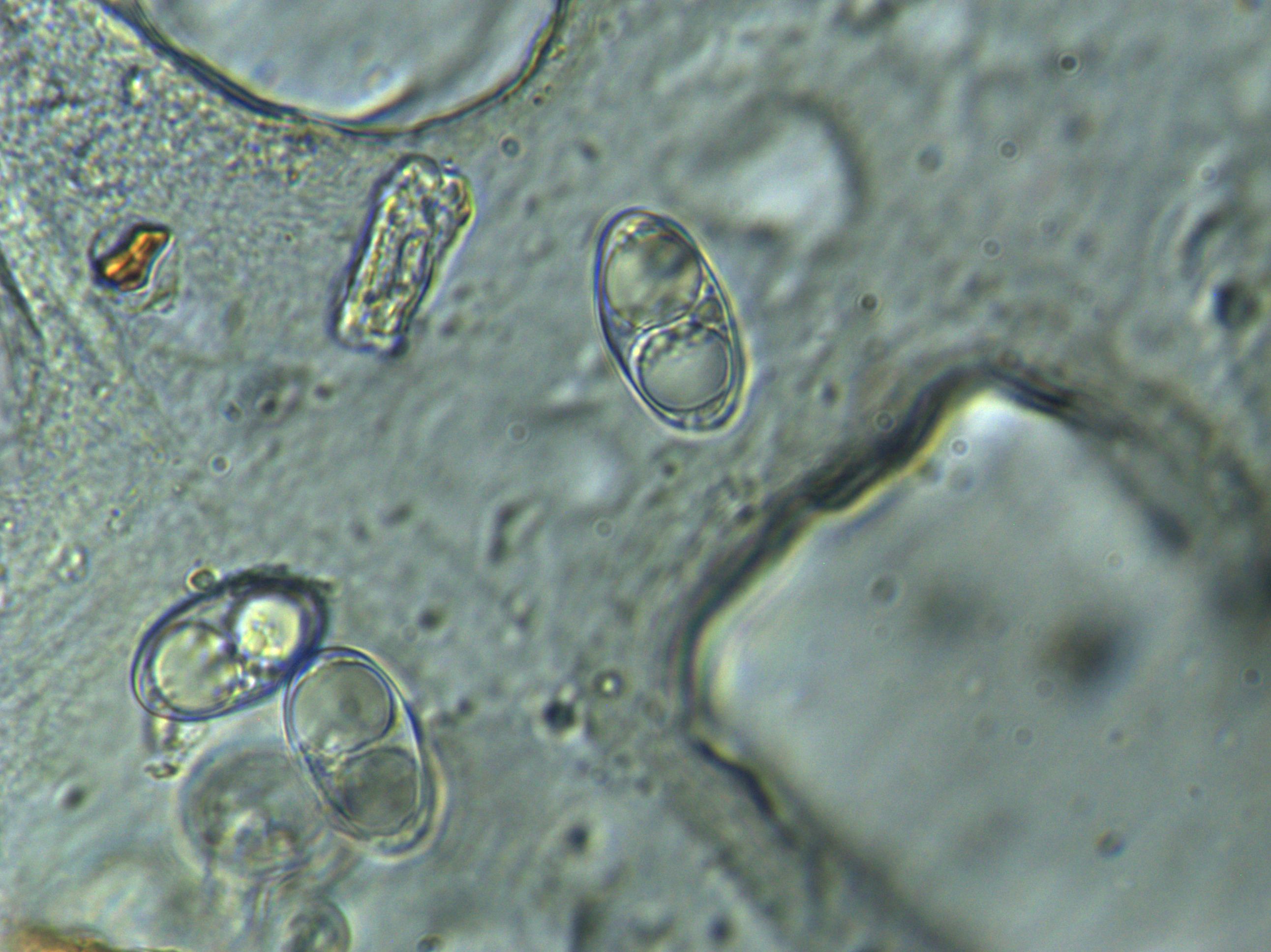 Spore in acqua